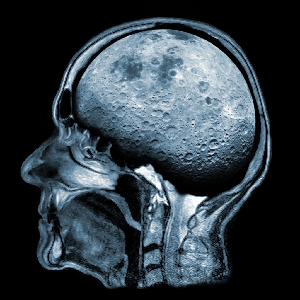 https://dev.universemagazine.com/wp-content/uploads/2022/08/1-mri-1.jpg