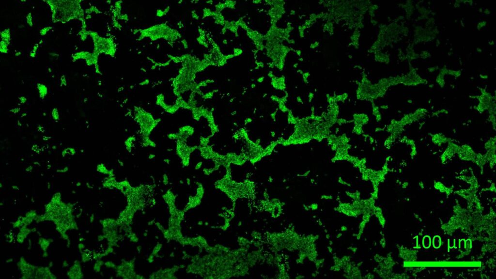 https://dev.universemagazine.com/wp-content/uploads/2023/04/bacillus-subtilis-biofilm.jpg