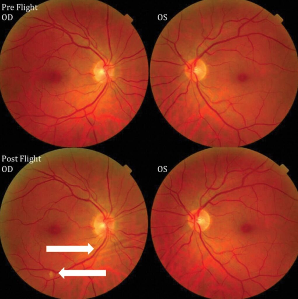 https://dev.universemagazine.com/wp-content/uploads/2023/12/eye-as22-paras-fig-1.jpg
