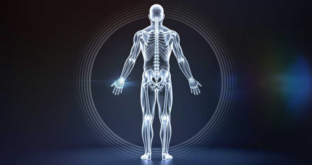 X-rays X-rays